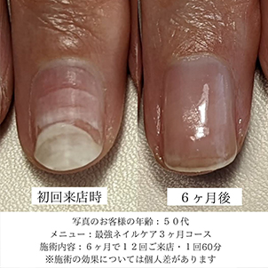 k・k様(52歳)