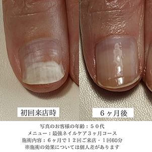 k・k様(52歳)