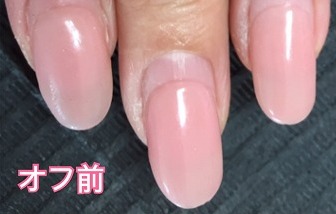 自爪に優しいフィルイン専門