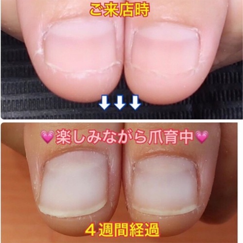爪の形は変えられます